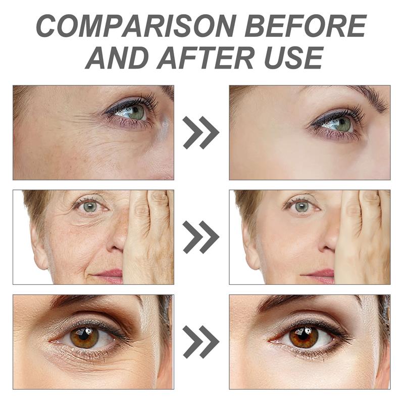 Retinol Remove Wrinkle Face Se - The Ordinary Serum Hyaluronic Acid ulasan dan harga