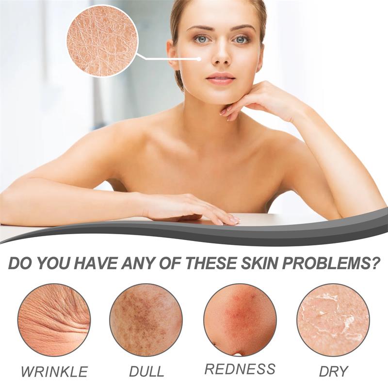 Retinol Remove Wrinkle Face Se - The Ordinary Serum Hyaluronic Acid ulasan dan harga
